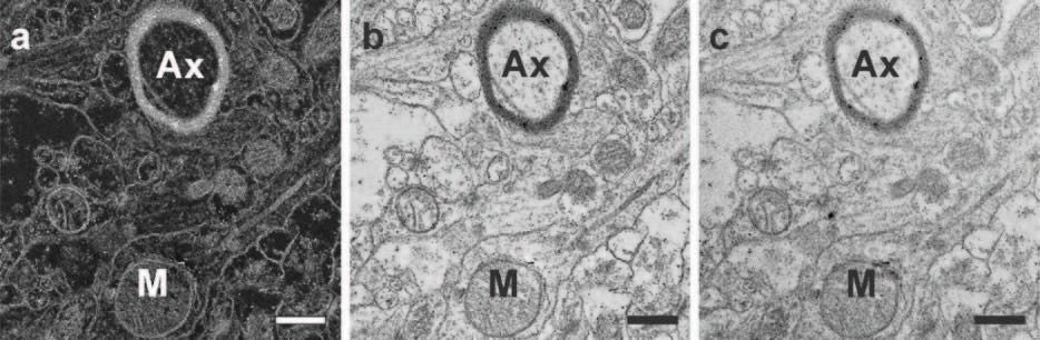 Resin Embedded Biological Samples Using STEM-HAADF Mode1
